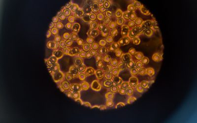 Microvascular System, what does this affect?